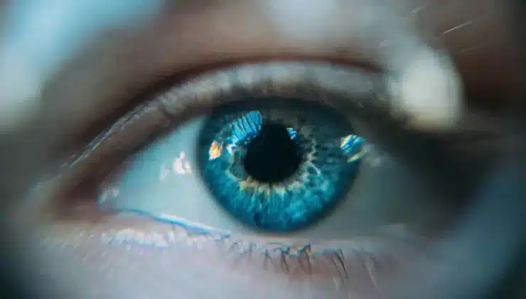 LASIK Treatment