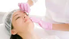 Facial Cosmetic Surgery